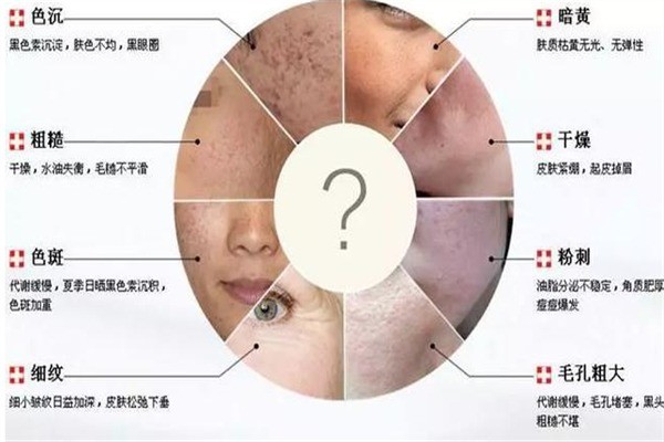 斑小七加盟
