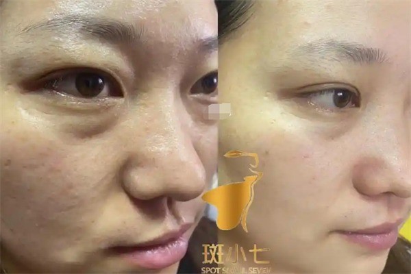 斑小七加盟