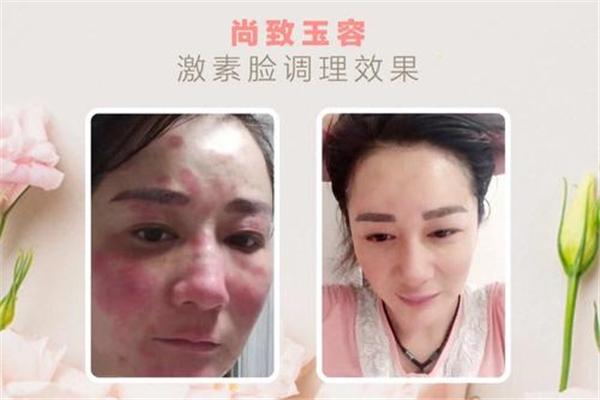 尚致玉容皮肤管理加盟