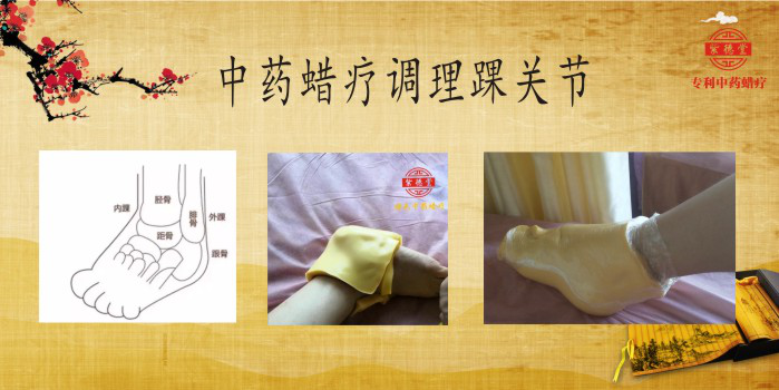 岳家草堂中药蜡疗加盟